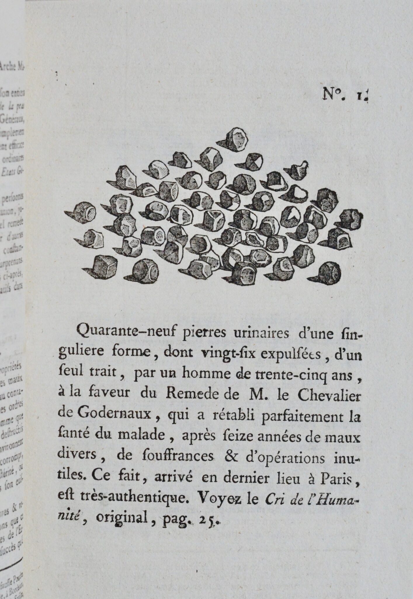 Curieux imprimé de 1789 contenant des gravures de bézoards et pierres urinaires